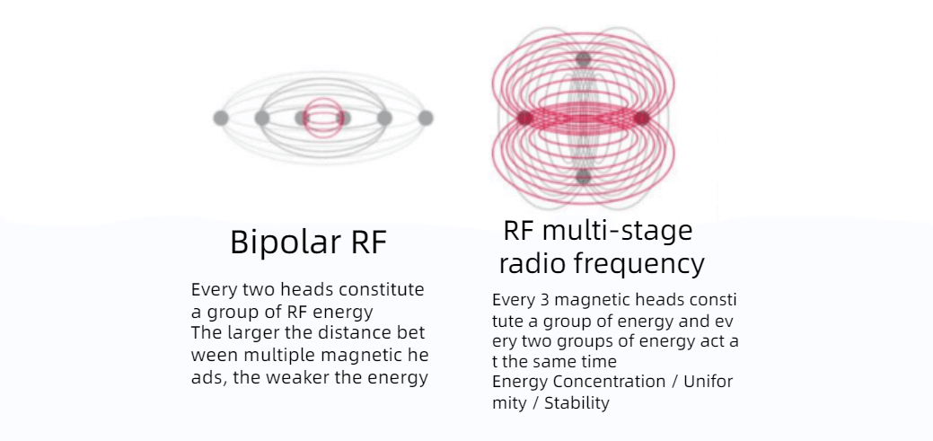 Why can the radio frequency technology of the beauty instrument be anti-aging?